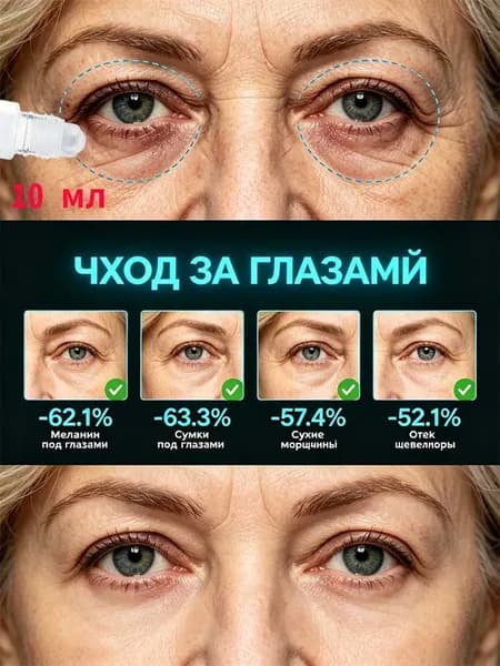 Крем для век от морщин.Устраните темные круги, мешки под глазами, отечность, выделение меланина, морщины и восстановите молодость и жизненную силу.10 мл
