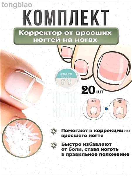 Корректор От Вросших Ногтей На Ногах