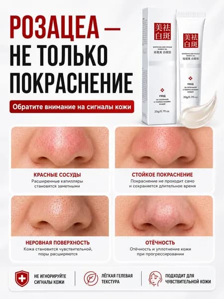 Крем от купероза для лица покраснений на лице и розацеа,Куперофаг Крем от купероза на лице, антикупероз, сред