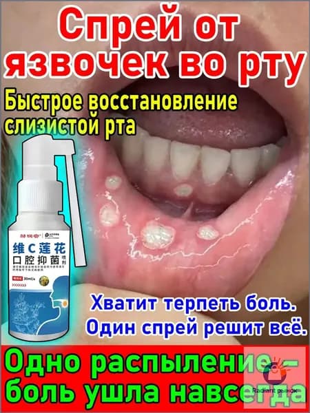 Спрей для облегчения боли во рту при язвах и стоматите,язв полости рта,мукозита,30 мл,обезболивающий,Растительный состав