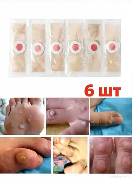 Пластырь от сухих мозолей стержневых, бородавок, натоптышей, шипиц , лейкопластырь