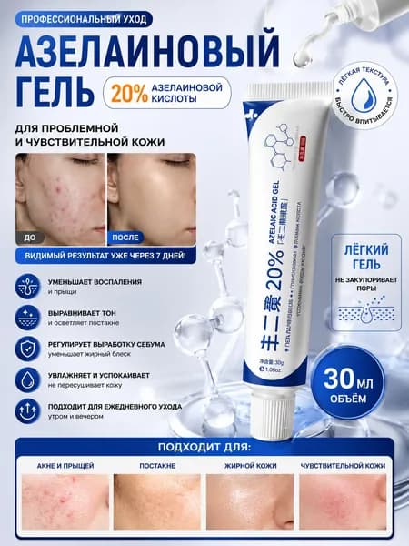 Гель с азелаиновой кислотой и 20%-ным кремом от прыщей уменьшает следы от прыщей 30ml *1