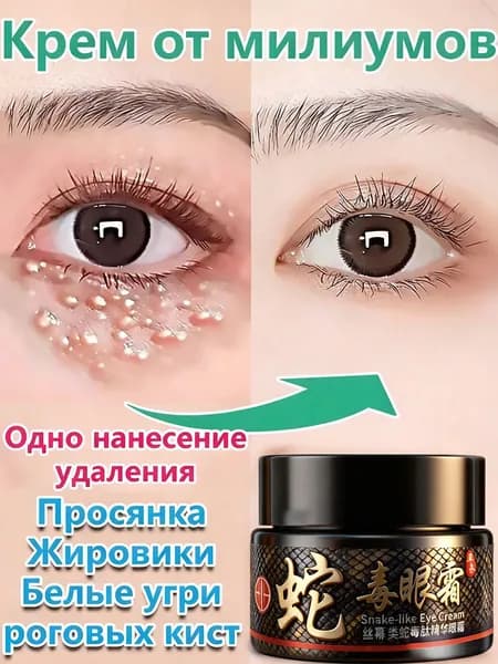 Эксклюзивный крем для устранения милиумов и липомы, показанный при подкожных жировых образованиях, отечности, целлюлите и фиброзном жировике