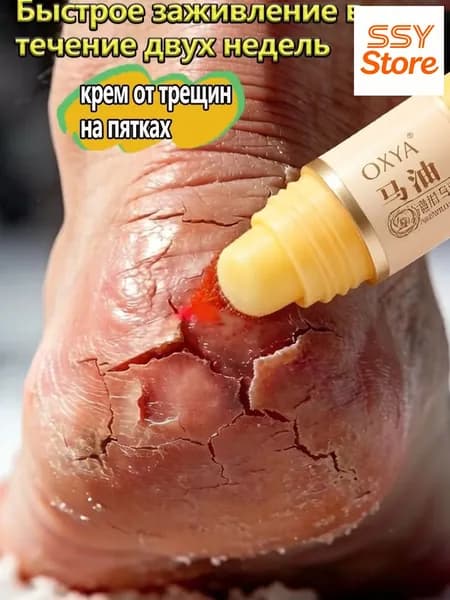 Премиум воск для пяток с мочевиной 5, применяемый при очень сухой коже и трещинах, для ног