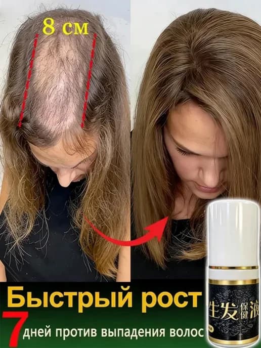 Концентрат бустер для роста волос на голове женский
