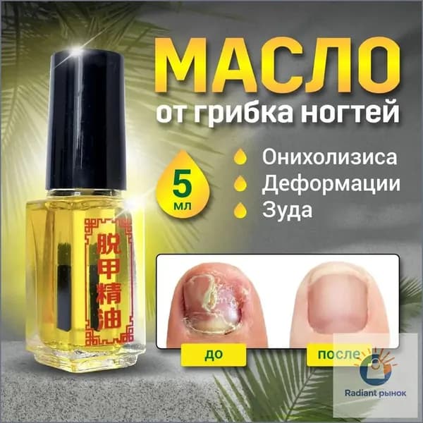 Лечение грибка ногтей, онихолизиса стоп, косметический гигиенический продукт: масло для ногтей и кутикулы