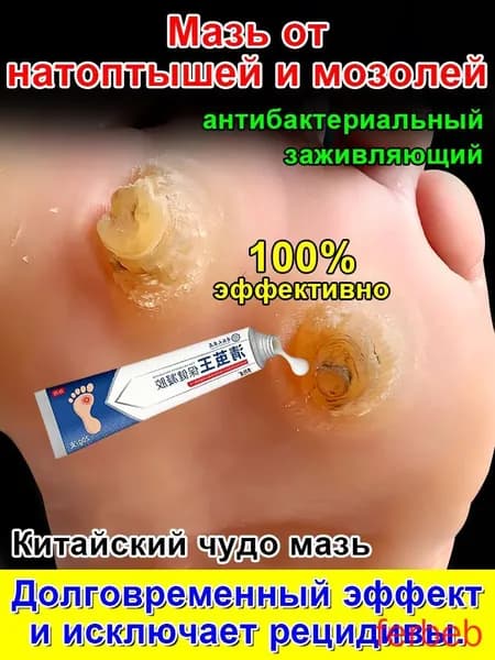 Mазь от мозолей стержневых и натоптышей ,Крем от сухих мозолей, шипицы, бородавок, натоптышей,20 г.(1)
