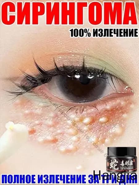 средство от милиумов на лице, Крем для век антивозрастной, для зоны вокруг глаз, ретидерм крем для век антивоз