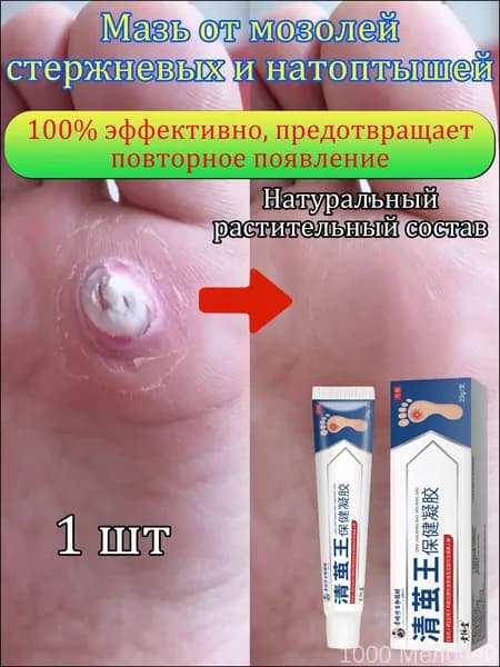Mазь от мозолей стержневых и натоптышей ,Крем от сухих мозолей, шипицы, бородавок, натоптышей,20 г 1 шт.