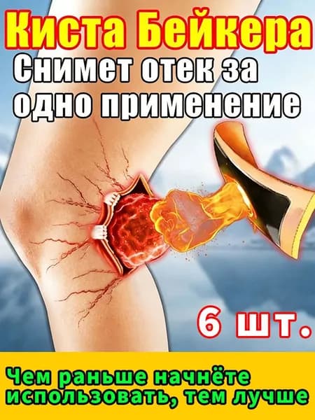 эффективное лечение кисты Бейкера и суставных болей