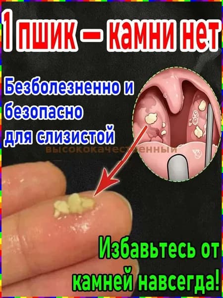 Устройство и спрей для удаления пробок из миндалин