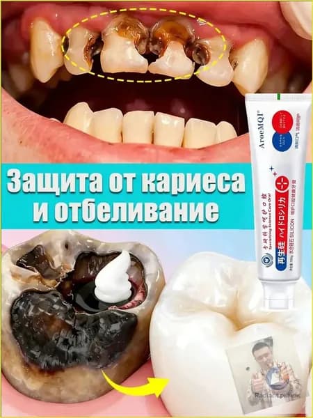 Зубная паста для дырки в зубе, глубокого кариеса и пульпита, Снимает боль, восстанавливает при поражении кариесом у взрослых, Свежее дыхание, 100 г, 1 шт.