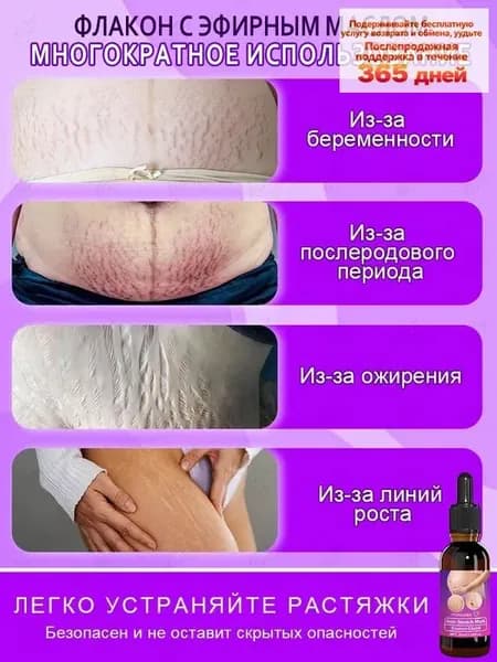 Масло для лечения растяжек. Специально разработано для беременных женщин и людей с избыточным весом. Устраняет жировые отложения, осветляет растяжки, питает кожу и борется с целлюлитом. 30 мл.