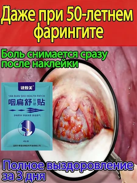 Акупрессурный пластырь при хроническом фарингите быстрое облегчение, без лекарств