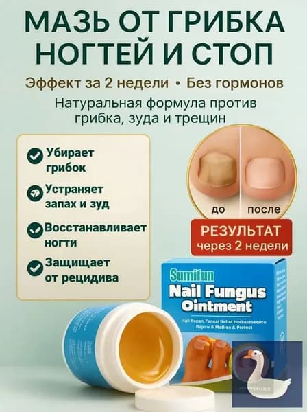 Мазь от грибка ногтей / Крем для эффективной борьбы с несовершенствами / Чудо средство для ухода за ногами против онихолизиса