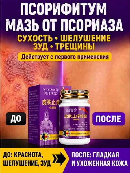 мазь от псориаза эффективная для тела