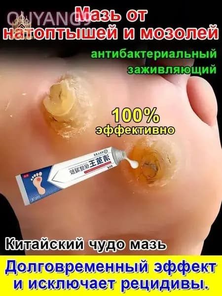 Mазь от мозолей стержневых и натоптышей ,Крем от сухих мозолей, шипицы, бородавок, натоптышей,20 г.