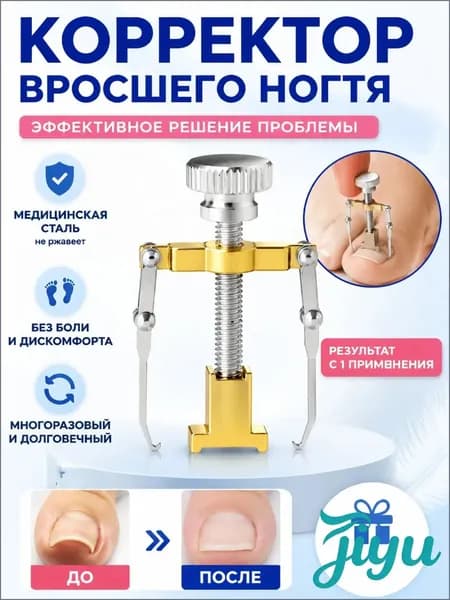 Коррекция вросших ногтей