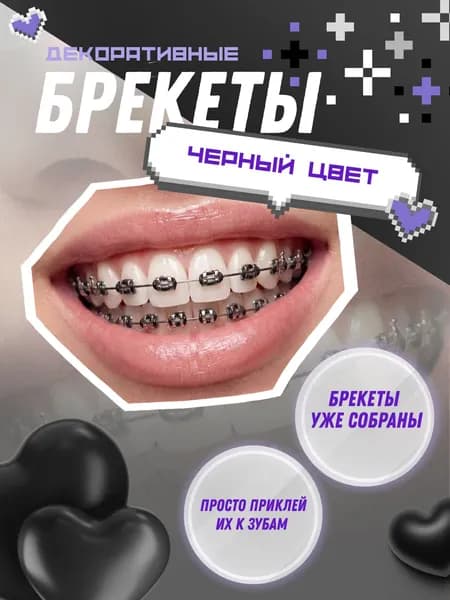 Брекеты для зубов черные верхние и нижние / Виниры 2 шт.