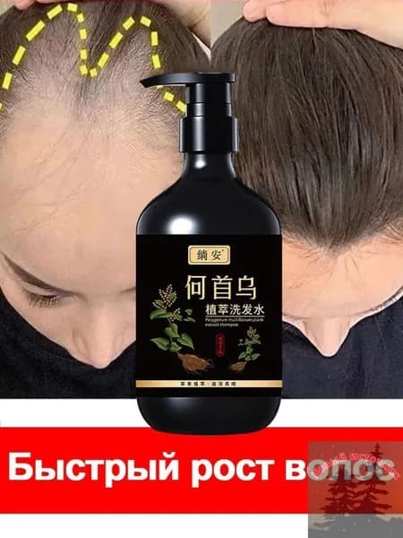 Шампунь для волос, 301 мл