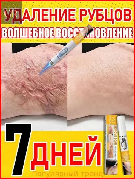Лазерная ручка для удаления шрамов, удаляет шрамы, родинки, ожоги, растяжки, следы ожирения, лечит послеоперационные шрамы, предотвращает образование рубцов, восстанавливает кожу.1 упаковка