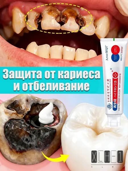 Зубная паста для лечения дырки в зубе, глубокого кариеса и пульпита, Снимает боль, восстанавливает при поражении кариесом у взрослых, Свежее дыхание, 100 г, 1 шт.