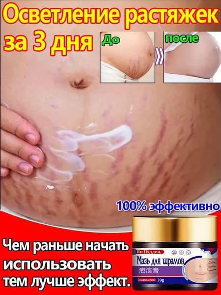 Быстро удаляет растяжки.Антицеллюлитное масло для тела.Подходит для борьбы с морщинами роста, ожирением и послеродовыми морщинками на животе.Нераздражающий.30 мл