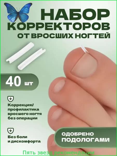 Корректор От Вросших Ногтей На Ногах1