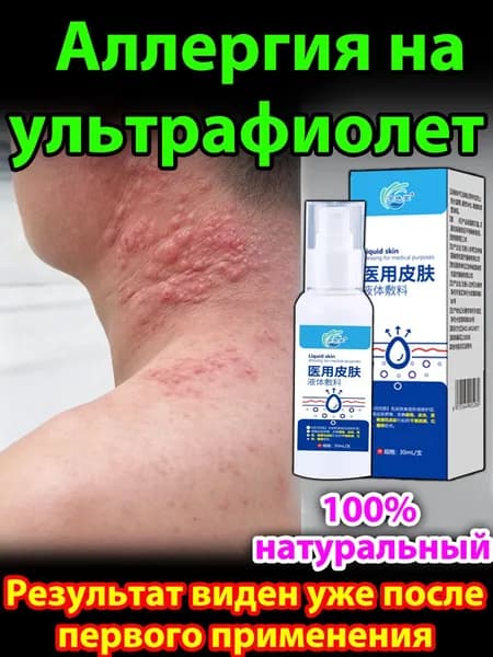 Крем для лечения солнечного дерматита,Восстановление кожи после солнечных ожогов крем после загара