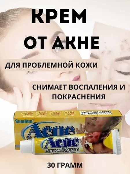 Эффективный крем от прыщей