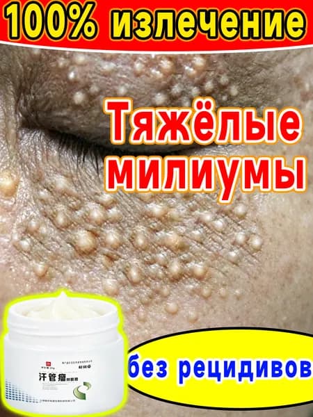 Средство от милиумов вокруг глаз сыворотка для удаления белых точек и жировиков, мягкое отшелушивание без повреждений, натуральные растительные компоненты