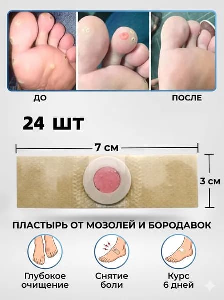 Мозольный пластырь удаляет мозоли