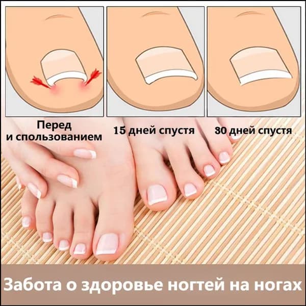 Премиумкорректор для ногтей