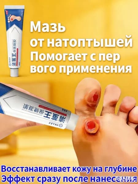 Крем от сухих мозолей и натоптышей. Мозольный бальзам для пяток, пилинг для ног.