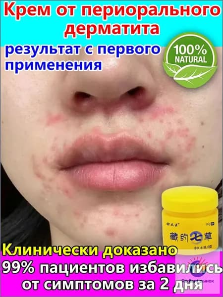 Восстанавливающая мазь для губ от герпеса, трещин и слюнного дерматита, 20 г