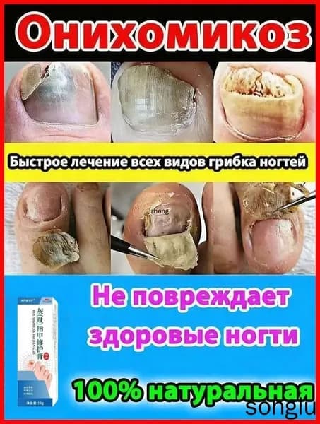 Противогрибковый крем от грибка ногтей на ногах, от трещин, для пяток и стоп, мазь от грибкового зуда, микоза/20г