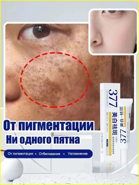 От пигментации Отбеливающий крем от пигментации AofuXue 30