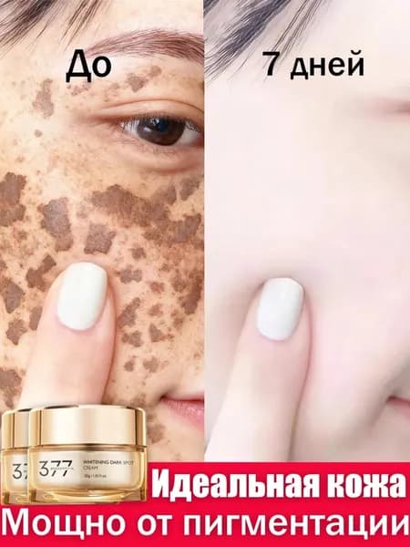 Крем для лица от веснушек и пигментации, Отбеливающий крем