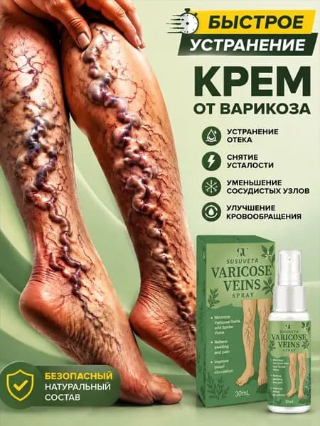 Крем от варикоза ног и вен на ногах: облегчение усталости и тяжести крем для ног от усталости и отеков ног эффективная мазь от варикоза для комфорта после долгого стояния и сидения