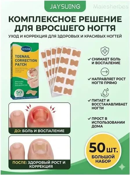 Эксклюзивный корректор врастания ногтевой пластины, 50 штук, качественный пластырь