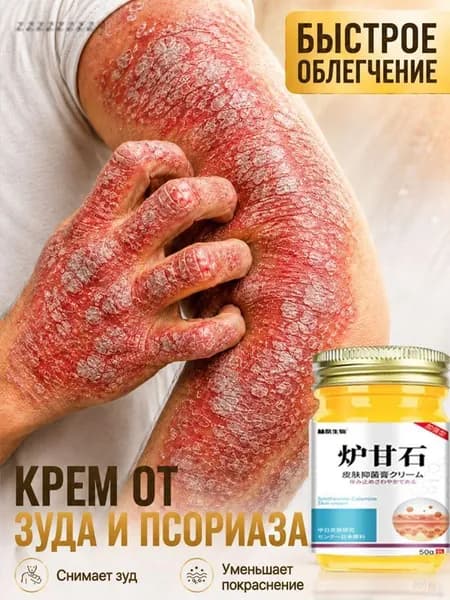 Негормональная мазь от псориаза, экземы, нейродермита и грибковых заболеваний, китайский крем от псориаза, 50 г.
