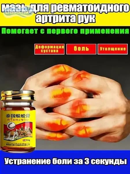 мазь для суставов артрит пальцев рук