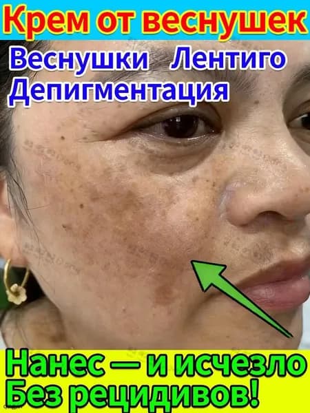 Антивозрастной крем от старческого лентиго и пигментных пятен с ретинолом 20 ML