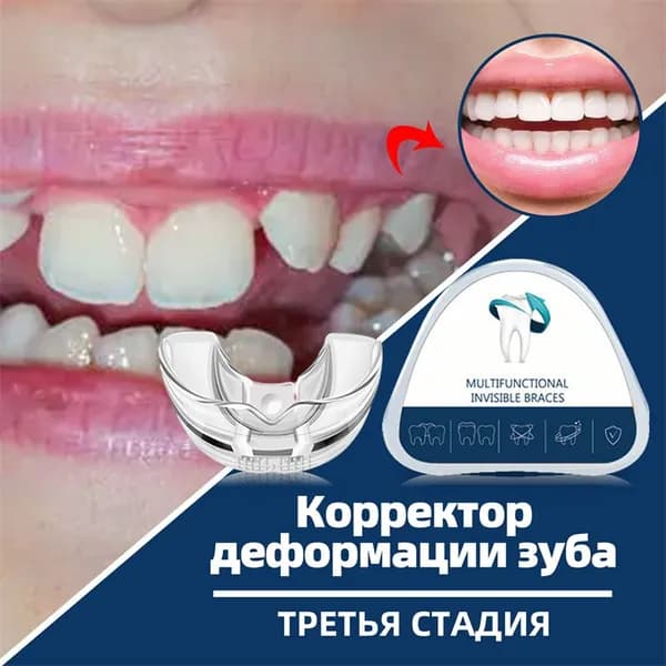 Жесткая трейнеров для зубов,Стоматологическая капа,Фаза 3,Для выравнивания зубов и исправления прикуса,взрослых