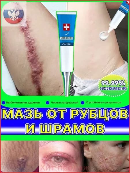 Гель от рубцов: для лечения растяжек, угревой сыпи, ожогов, послеоперационных и келоидных рубцов, 100 мл