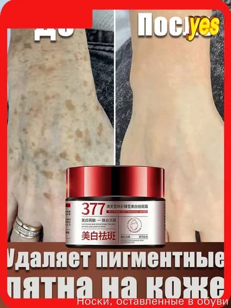 Крем от пигментации для лица 30 г эффективно удаляет веснушки,пигментные пятна солнечные ожоги,старческие пятна,восстанавливает кожу,осветляет тон кожи