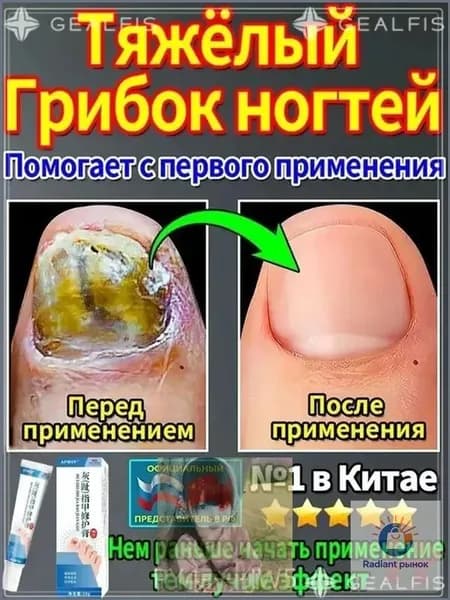мазь ноготок от грибка ногтей на ногах,Лечите грибковые инфекции, укрепляйте и восстанавливайте ногти и рого