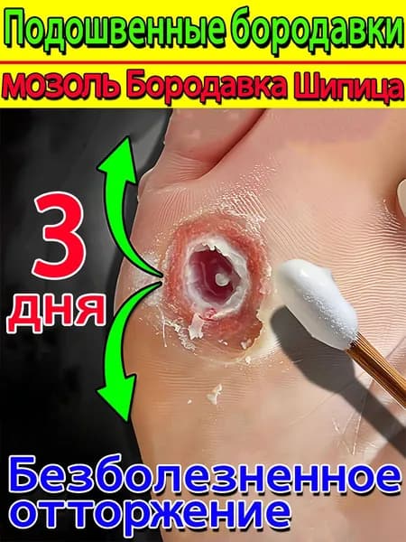 Эффективная мазь для удаления мозолей и шипиц на ногах