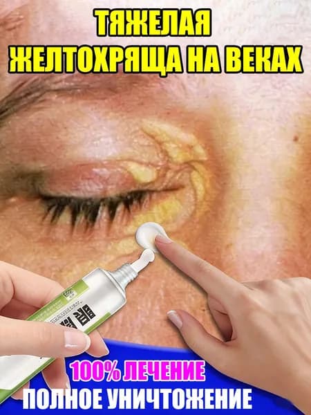 Крем для век от ксантелазмы, синяков и морщин фитотерапия без операции, уход за кожей вокруг глаз, без побочных эффектов.