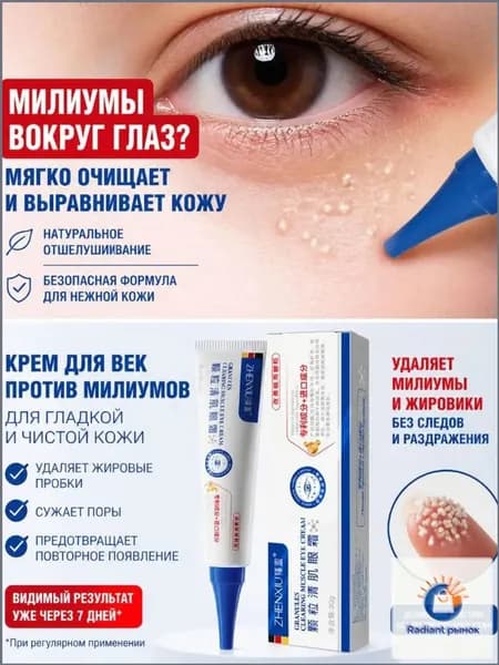 Эксклюзивная мазь от жировых гранул на веках, быстрое удаление милиумов под глазами, крем для качественного ухода